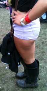 Should girls with cellulite wear shorts? 