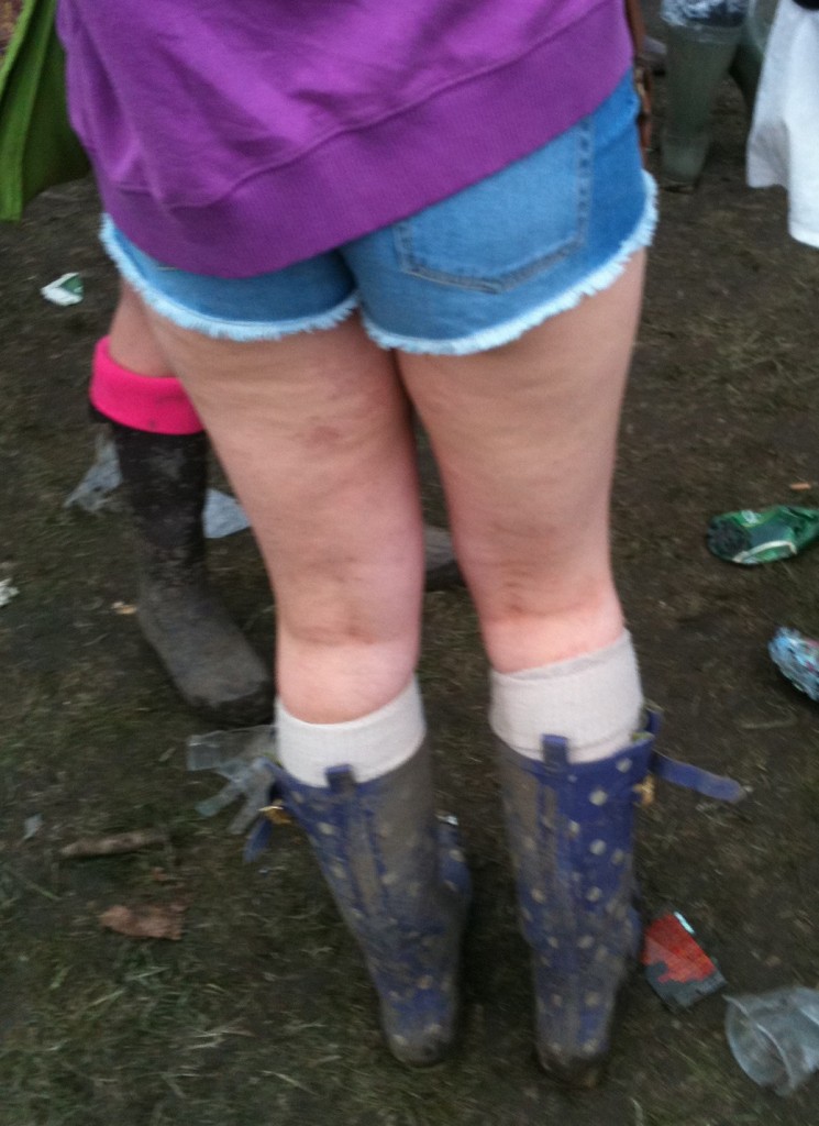 Cellulite at Parklife Festival 